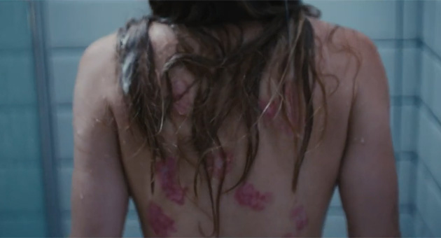 Almirall dreht Bewegtbild-Serie zu Psoriasis - Mit der Serie 'Nina' möchte Almirall die Auswirkungen auf das Wohlbefinden von Psoriasis-Patienten in den Mittelpunkt stellen - Foto: Screenshot/Almirall