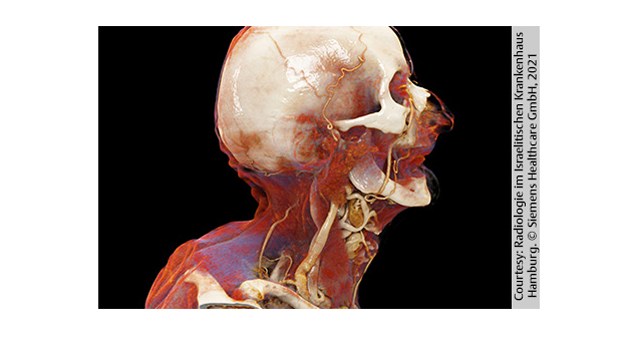 Durch die Anwendung von Cinematic Anatomy sind anatomische 3D-Visualisierungen wichtiger Krperregionen auf 'via medici' verfgbar - Foto: Siemens Healthineers