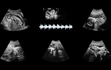 Der Ultraschall-Sound der ungeborenen Babies bildet die Grundlage fr die komponierte 'Ode an die Zukunft' (Foto: Fork Unstable Media)