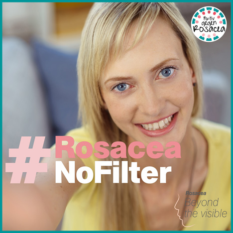 Rosacea-Patienten sollen unter dem Hashtag #RosaceaNoFilter Selfies bei Instagram gegen die Stigmatisierung posten (Foto: Galderma) 
