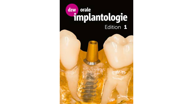 'dzw orale implantologie Edition' richtet sich an implantologisch ttige Zahnrzte - Abb: ZFV